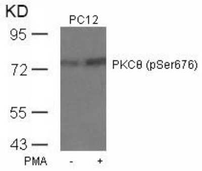 Western Blot: PKC theta [p Ser676] Antibody [NB100-82145]